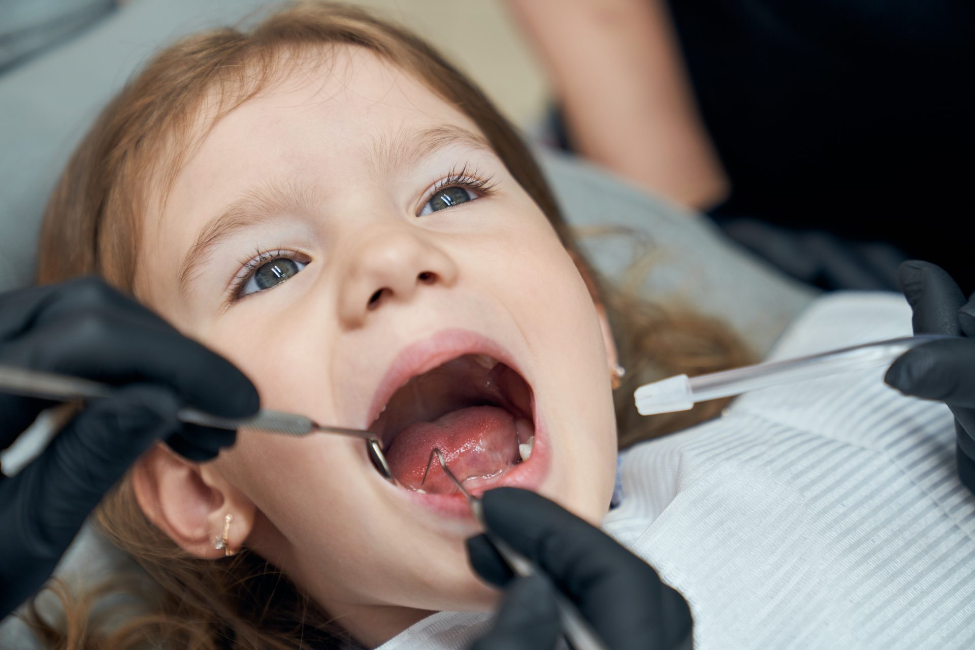 Çocuğunuzu İlk Diş Kontrolüne Nasıl Hazırlayacaksınız?