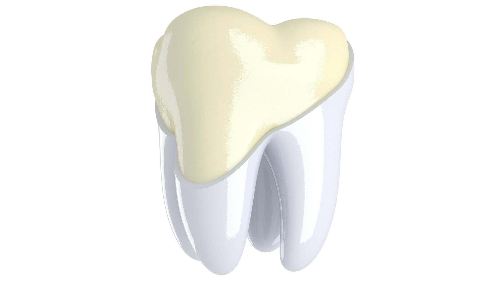 What is Tooth Enamel Hypocalcification? Is There a Treatment?